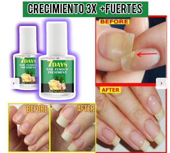 Serum Crece Max-™