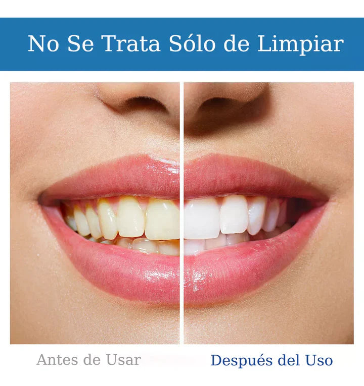 NOBS_ Sonrisa Perfecta ™ - Blanqueador Dental